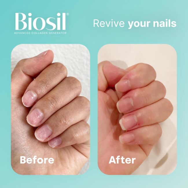 Biosil Collagen Generator 30 Original Capsules - Image 7